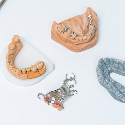 Pose de prothèse dentaire à Namur | VOCLIdental